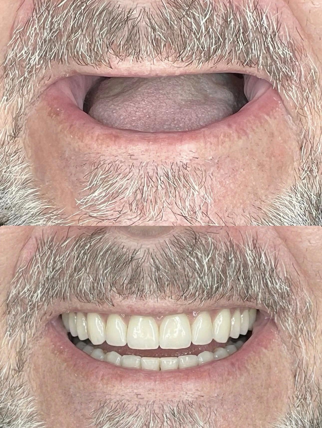 Hasta gülüş dönüşümü 1